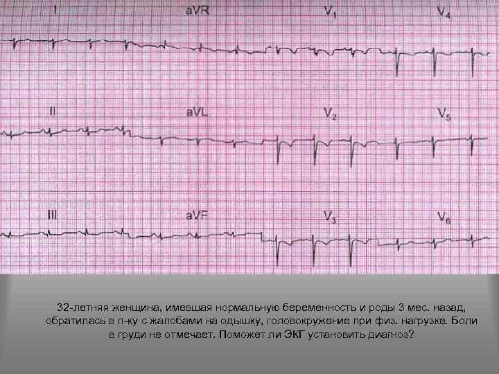 32 -летняя женщина, имевшая нормальную беременность и роды 3 мес. назад, обратилась в п-ку