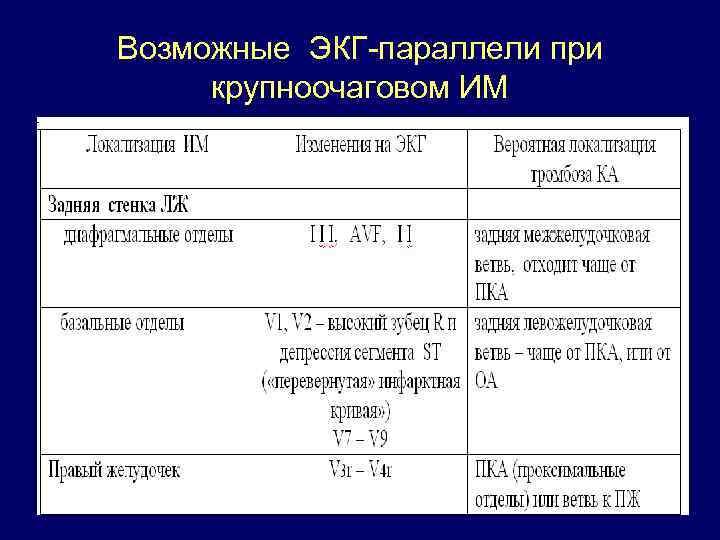 Возможные ЭКГ-параллели при крупноочаговом ИМ 