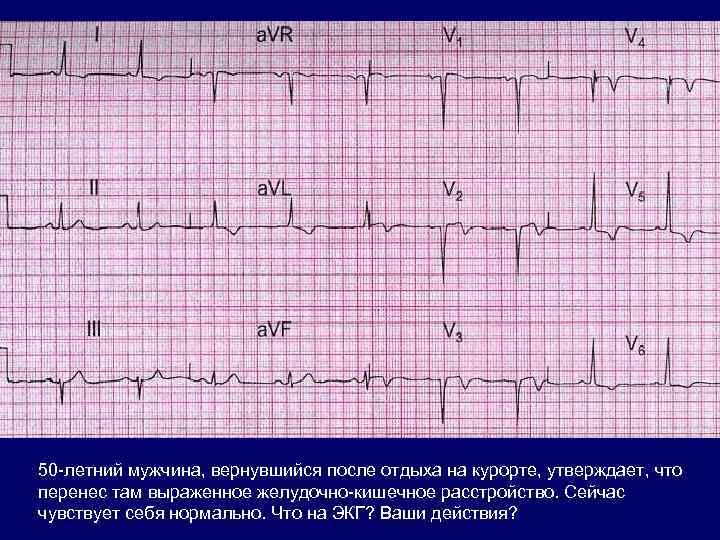 50 -летний мужчина, вернувшийся после отдыха на курорте, утверждает, что перенес там выраженное желудочно-кишечное
