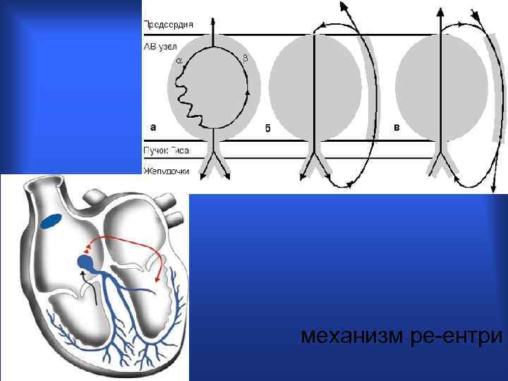 механизм ре-ентри 