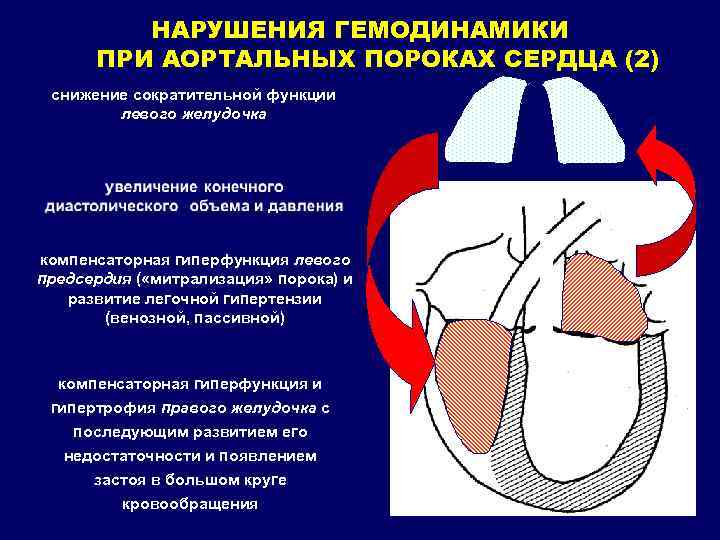 НАРУШЕНИЯ ГЕМОДИНАМИКИ ПРИ АОРТАЛЬНЫХ ПОРОКАХ СЕРДЦА (2) снижение сократительной функции левого желудочка компенсаторная гиперфункция