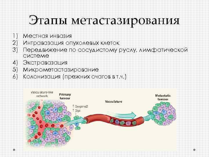 Этапы метастазирования 1) Местная инвазия 2) Интравазация опухолевых клеток 3) Передвижение по сосудистому руслу,