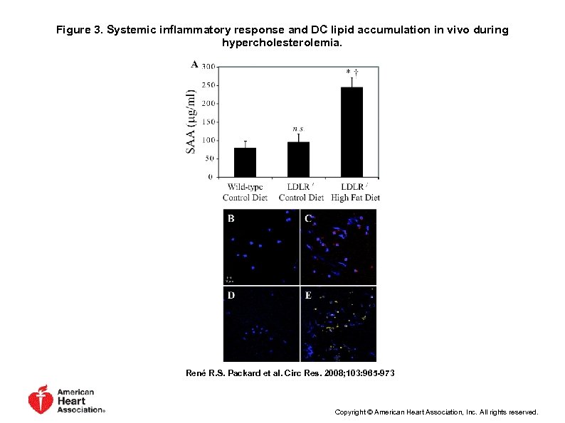 Figure 3. Systemic inflammatory response and DC lipid accumulation in vivo during hypercholesterolemia. René