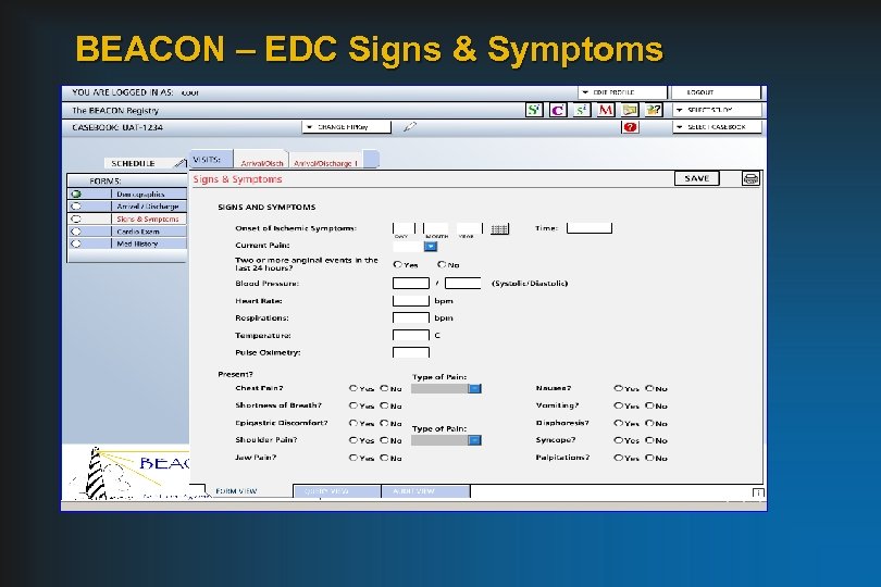 BEACON – EDC Signs & Symptoms 