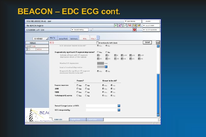 BEACON – EDC ECG cont. 