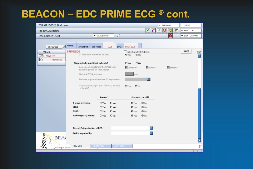 BEACON – EDC PRIME ECG ® cont. 