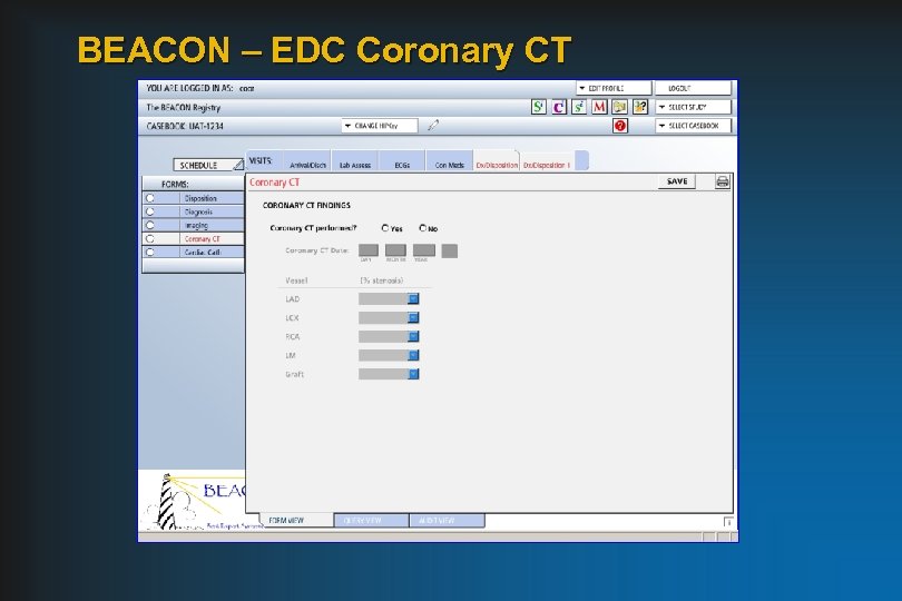 BEACON – EDC Coronary CT 