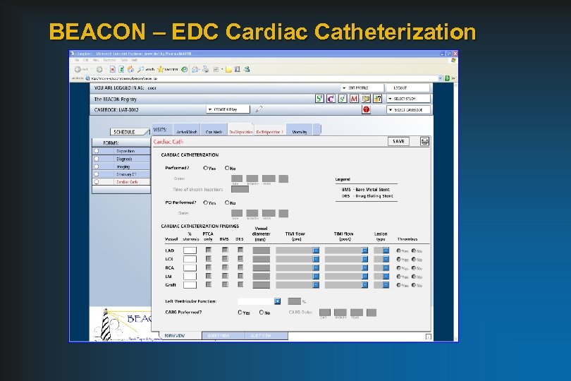 BEACON – EDC Cardiac Catheterization 