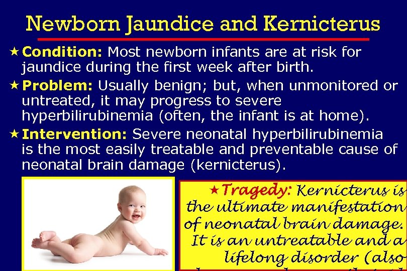 Newborn Jaundice and Kernicterus « Condition: Most newborn infants are at risk for jaundice