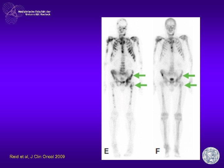 Reid et al, J Clin Oncol 2009 