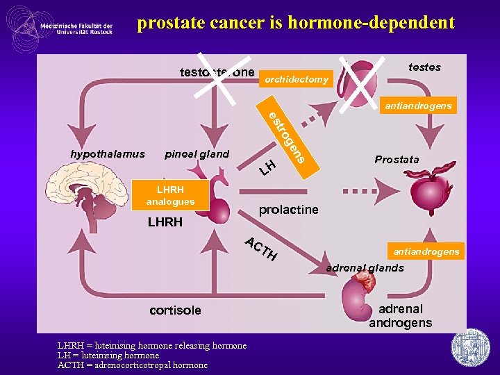 Is grade 3 prostate cancer serious
