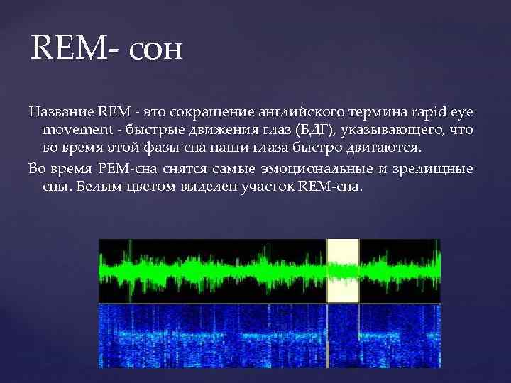 REM- сон Название REM - это сокращение английского термина rapid eye movement - быстрые
