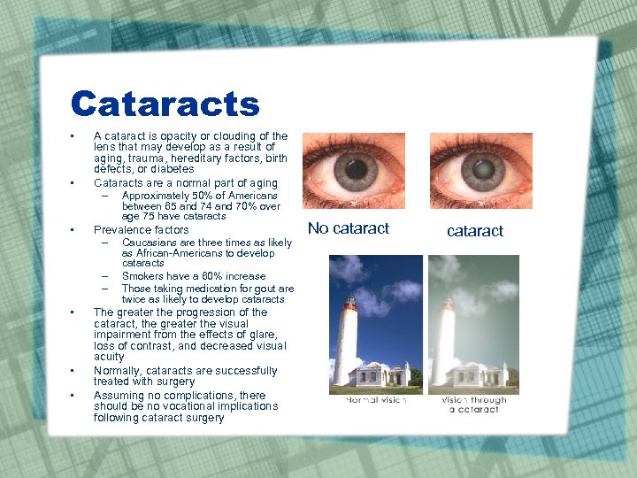 Cataracts • • A cataract is opacity or clouding of the lens that may