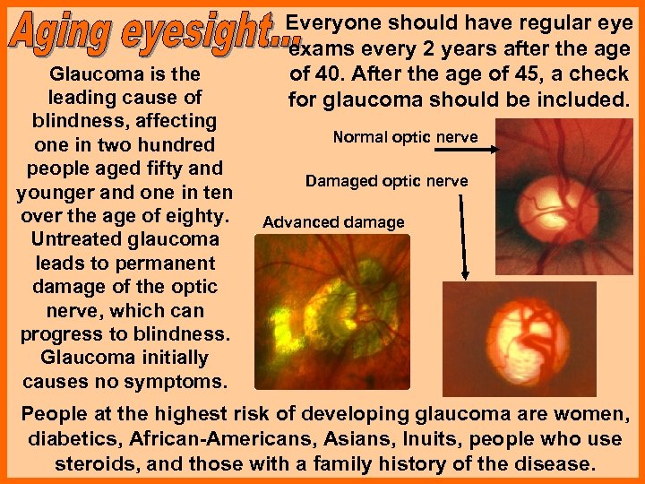 Glaucoma is the leading cause of blindness, affecting one in two hundred people aged