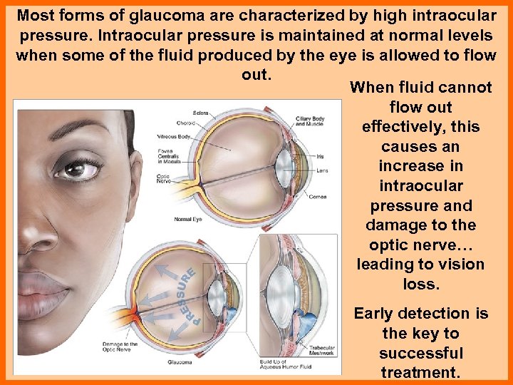 Most forms of glaucoma are characterized by high intraocular pressure. Intraocular pressure is maintained