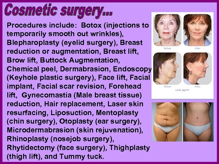 Procedures include: Botox (injections to temporarily smooth out wrinkles), Blepharoplasty (eyelid surgery), Breast reduction