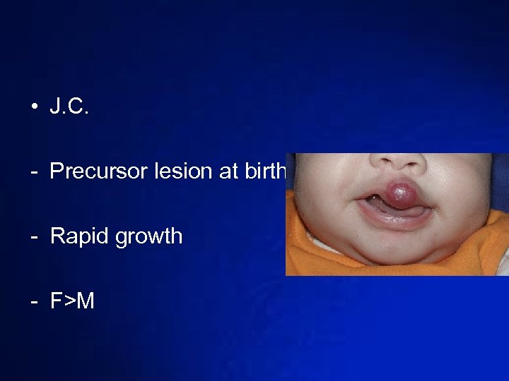  • J. C. - Precursor lesion at birth - Rapid growth - F>M
