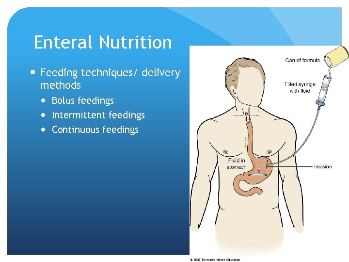 Enteral Nutrition Feeding techniques/ delivery methods Bolus feedings Intermittent feedings Continuous feedings © 2007