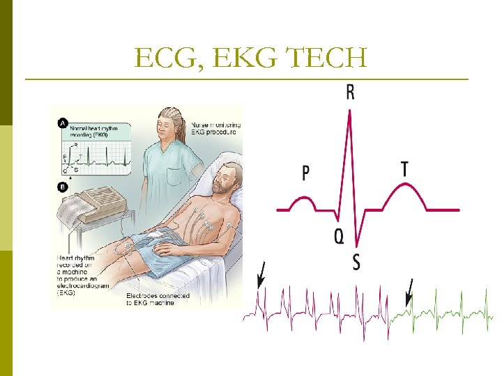 ECG, EKG TECH 