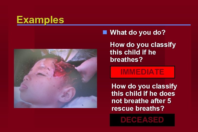 Examples n What do you do? How do you classify this child if he