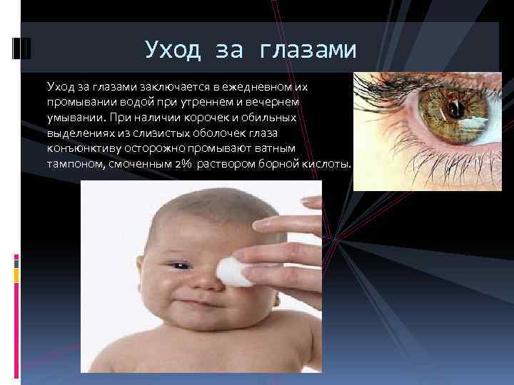 Уход за глазами заключается в ежедневном их промывании водой при утреннем и вечернем умывании.