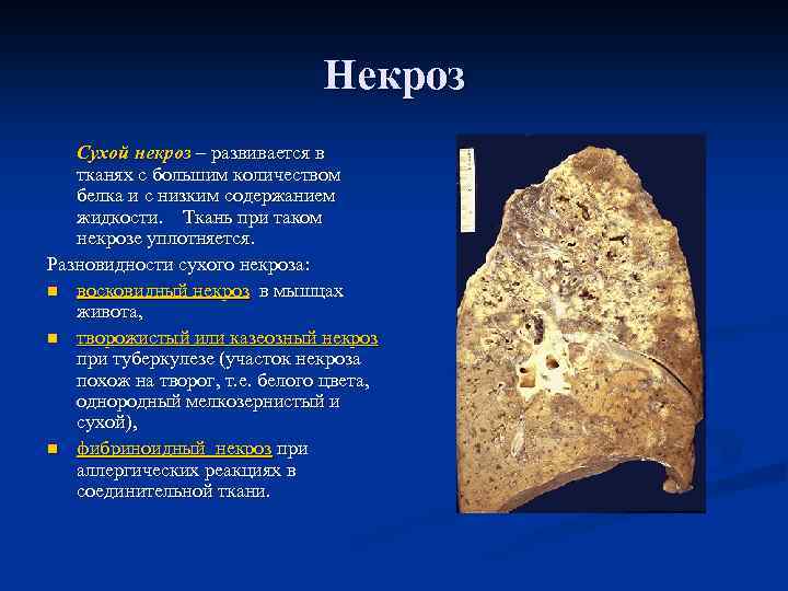 Апоптоз патанатомия презентация