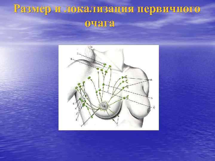 Размер и локализация первичного очага 