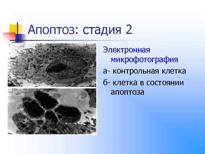 Апоптоз: стадия 2 Электронная микрофотография а- контрольная клетка б- клетка в состоянии апоптоза 