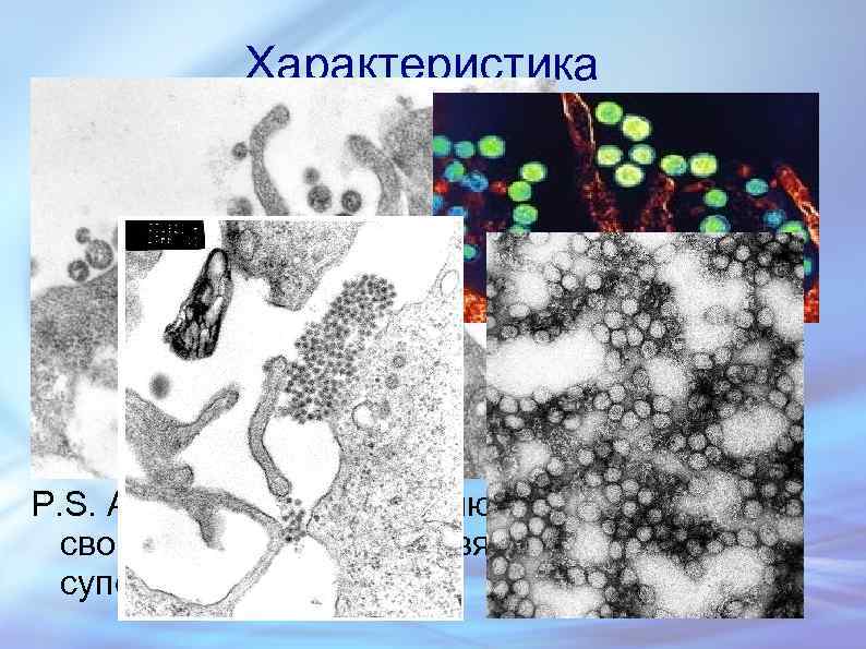 Характеристика Размеры от 30 до 180 нм, форма сферическая или палочковидная Имеют одноцепочечную геномную