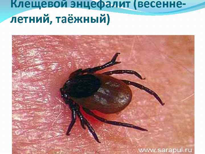Клещевой энцефалит (весеннелетний, таёжный) 