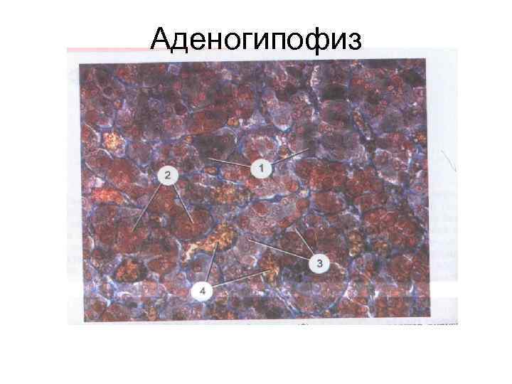 Аденогипофиз 