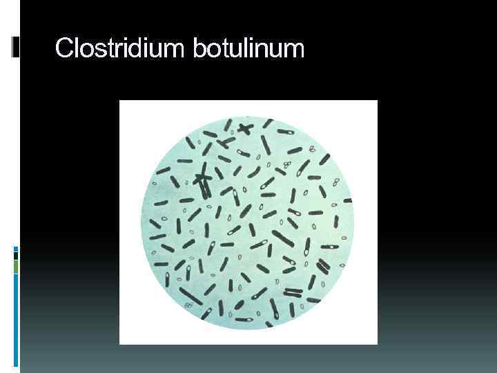 Clostridium botulinum 