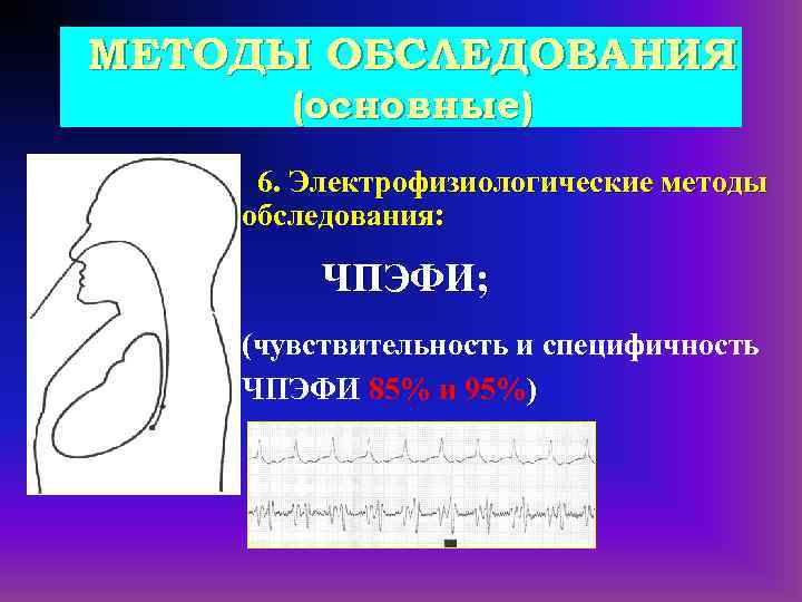 МЕТОДЫ ОБСЛЕДОВАНИЯ (основные) 6. Электрофизиологические методы обследования: ЧПЭФИ; (чувствительность и специфичность ЧПЭФИ 85% и