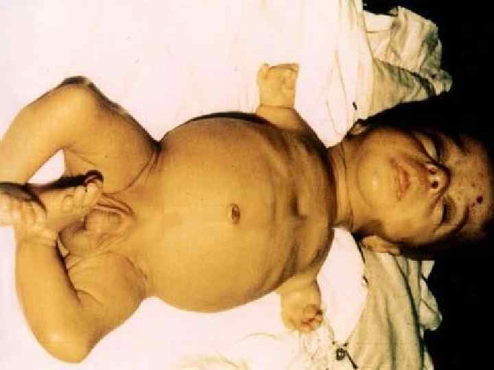 ПОРАЖАЮЩИЕ ФАКТОРЫ ЯДЕРНОГО ВЗРЫВА ПРОНИКАЮЩАЯ РАДИАЦИЯ 