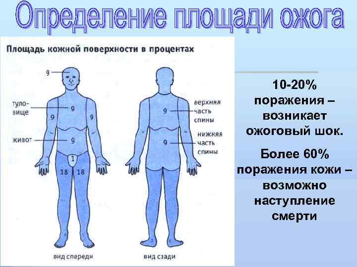 10 -20% поражения – возникает ожоговый шок. Более 60% поражения кожи – возможно наступление