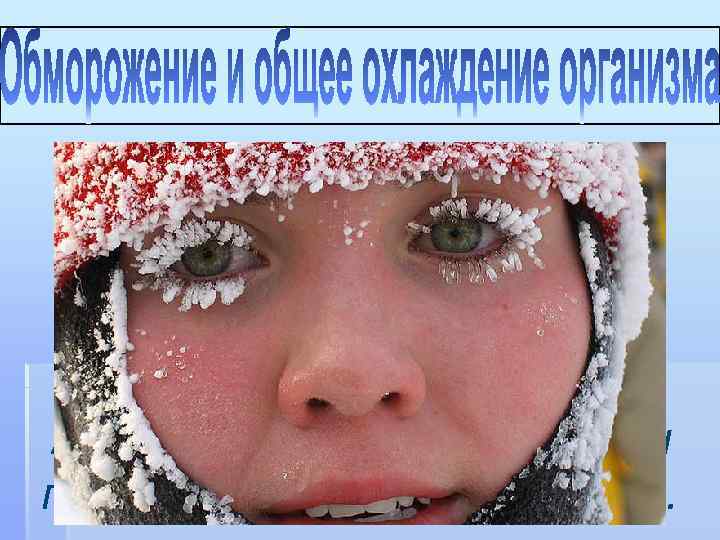 Наступают при температуре воздуха ниже -6°С. Снижение внутренней температуры тела ниже 24°С при общем