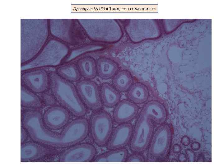 Препарат № 150 «Придаток семенника» 
