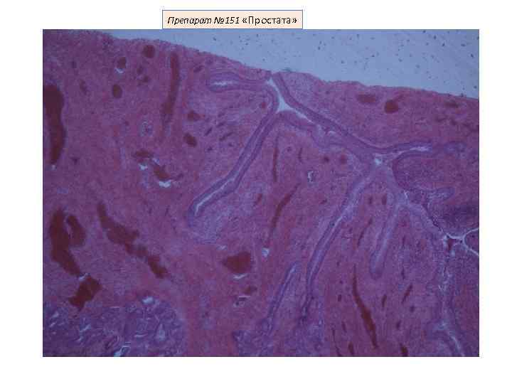 Препарат № 151 «Простата» 