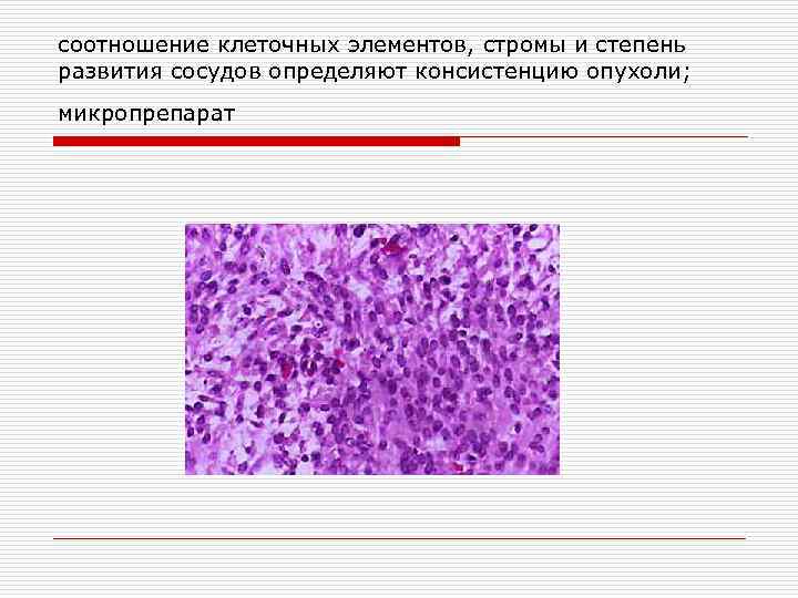 соотношение клеточных элементов, стромы и степень развития сосудов определяют консистенцию опухоли; микропрепарат 