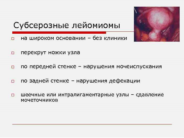 Субсерозные лейомиомы o на широком основании – без клиники o перекрут ножки узла o