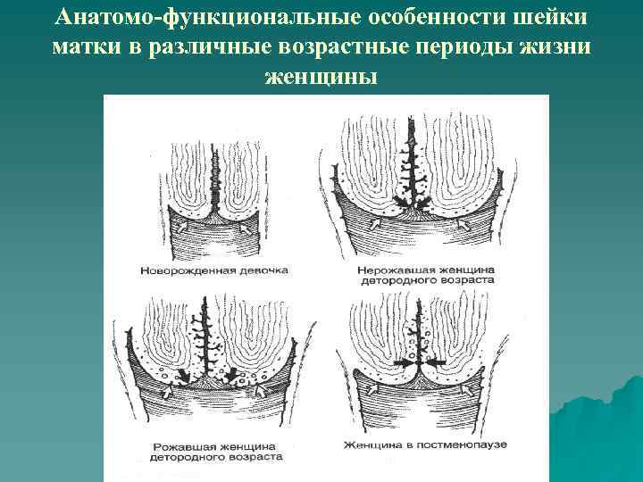 Строение шейки матки в картинках