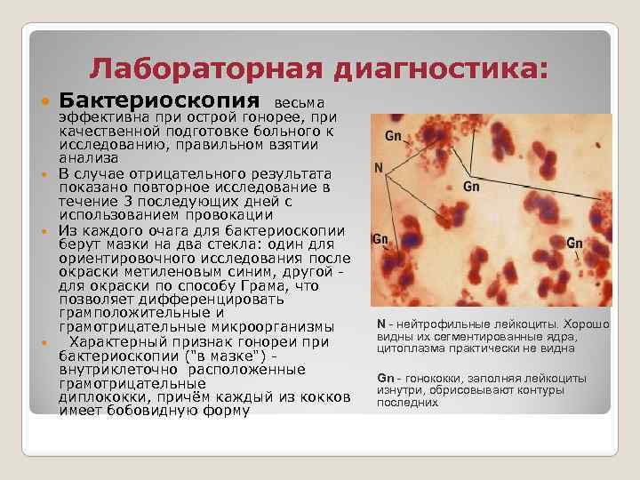 Трихомониаз презентация дерматовенерология