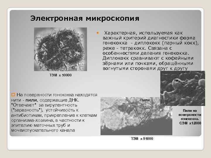 Электронная микроскопия Характерная, используемая как важный критерий диагностики форма гонококка - диплококк (парный кокк),