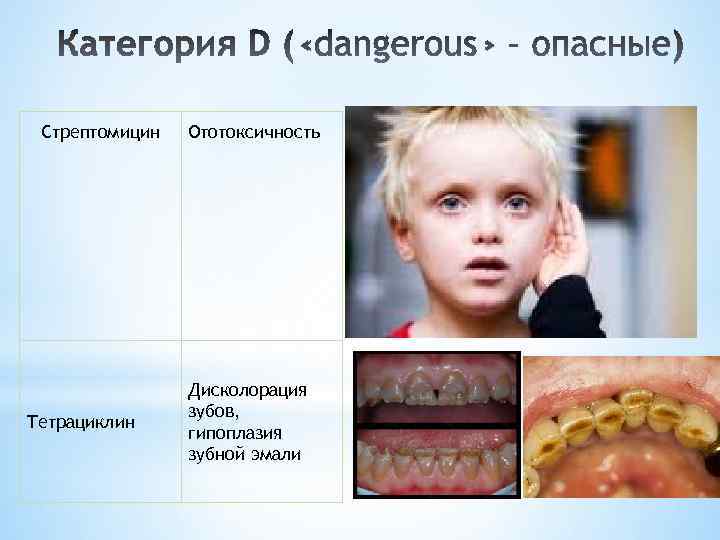 Стрептомицин Тетрациклин Ототоксичность Дисколорация зубов, гипоплазия зубной эмали 