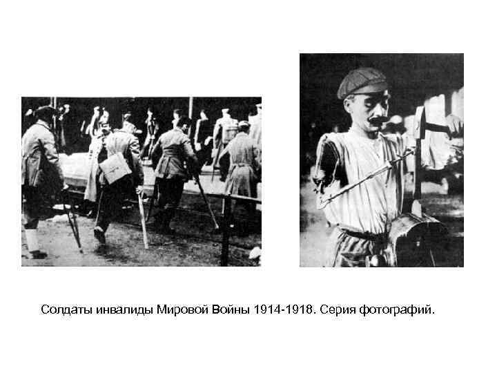 Солдаты инвалиды Мировой Войны 1914 -1918. Серия фотографий. 