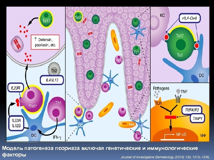 Модель патогенеза псориаза включая генетические и иммунологические факторы Journal of Investigative Dermatology (2010) 130,