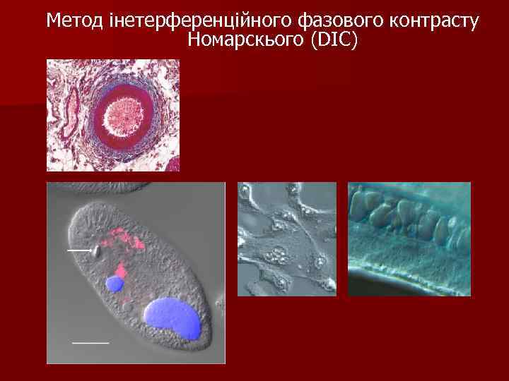 Метод інетерференційного фазового контрасту Номарскього (DIC) 