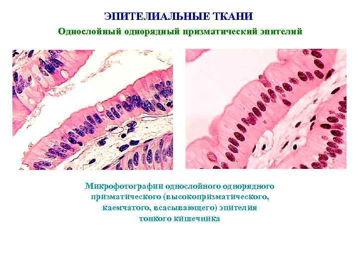 ЭПИТЕЛИАЛЬНЫЕ ТКАНИ Однослойный однорядный призматический эпителий Микрофотографии однослойного однорядного призматического (высокопризматического, каемчатого, всасывающего) эпителия