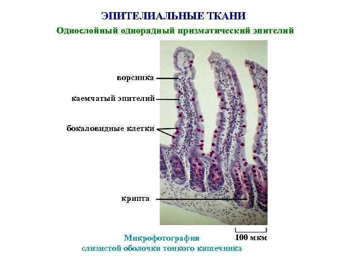 ЭПИТЕЛИАЛЬНЫЕ ТКАНИ Однослойный однорядный призматический эпителий ворсинка каемчатый эпителий бокаловидные клетки крипта 100 мкм