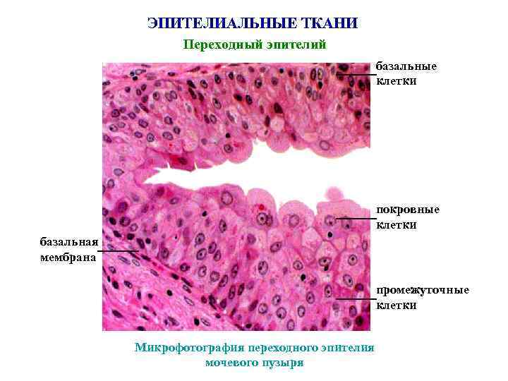 ЭПИТЕЛИАЛЬНЫЕ ТКАНИ Переходный эпителий базальные клетки покровные клетки базальная мембрана промежуточные клетки Микрофотография переходного